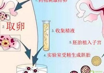 去泰国做第三代试管生孩子究竟花多少钱？10万够吗？