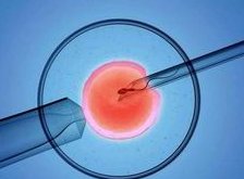 北流市生孩子做染色体检查有必要吗，筛查一次大概需要多少钱？