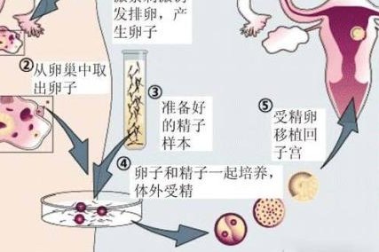 女性子宫肌瘤在新乡医学院第三附属医院做三代试管预算八万块够不够？
